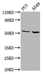 CSB-PA007859LA01HU