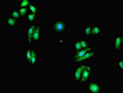Immunofluorescent analysis of HepG2 cells using CSB-PA007865LA01HU at dilution of 1:100 and Alexa Fluor 488-congugated AffiniPure Goat Anti-Rabbit IgG(H+L)