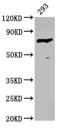 Western Blot Positive WB detected in: 293 whole cell lysate All lanes: F13B antibody at 4.17microg/ml Secondary Goat polyclonal to rabbit IgG at 1/50000 dilution Predicted band size: 76 kDa Observed band size: 76 kDa Western Blot Positive WB detected in: 293 whole cell lysate All lanes: F13B antibody at 4.17microg/ml Secondary Goat polyclonal to rabbit IgG at 1/50000 dilution Predicted band size: 76 kDa Observed band size: 76 kDa