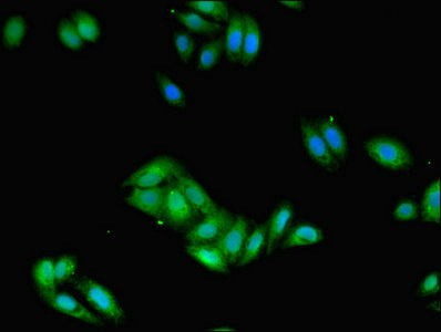 Immunofluorescent analysis of HepG2 cells using CSB-PA008533LA01HU at dilution of 1:100 and Alexa Fluor 488-congugated AffiniPure Goat Anti-Rabbit IgG(H+L)
