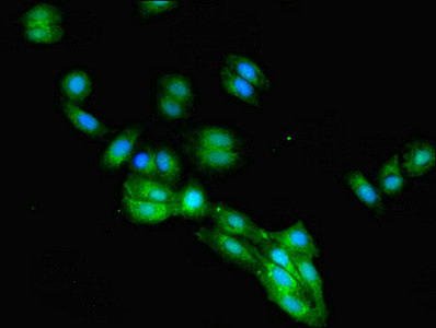 Immunofluorescent analysis of HepG2 cells using CSB-PA008545EA01HU at dilution of 1:100 and Alexa Fluor 488-congugated AffiniPure Goat Anti-Rabbit IgG(H+L)