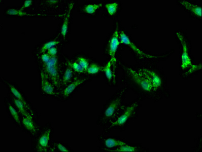 CSB-PA008646LA01HU