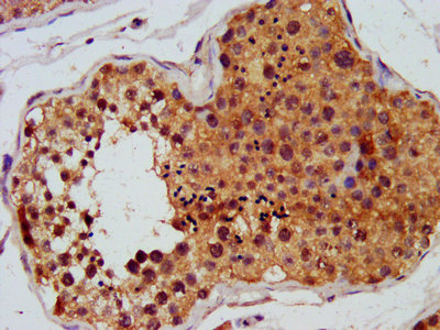 CSB-PA008646LA01HU