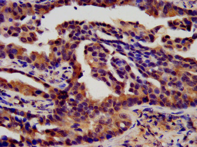 CSB-PA008646LA01HU
