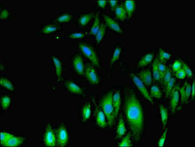 Immunofluorescent analysis of Hela cells using CSB-PA008659LA01HU at dilution of 1:100 and Alexa Fluor 488-congugated AffiniPure Goat Anti-Rabbit IgG(H+L)