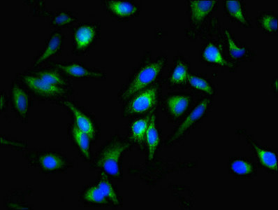 Immunofluorescent analysis of Hela cells using CSB-PA008684LA01HU at dilution of 1:100 and Alexa Fluor 488-congugated AffiniPure Goat Anti-Rabbit IgG(H+L)