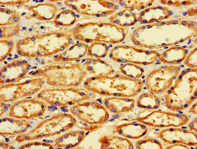 IHC image of CSB-PA008684LA01HU diluted at 1:600 and staining in paraffin-embedded human kidney tissue performed on a Leica BondTM system. After dewaxing and hydration, antigen retrieval was mediated by high pressure in a citrate buffer (pH 6.0). Section was blocked with 10% normal goat serum 30min at RT. Then primary antibody (1% BSA) was incubated at 4°C overnight. The primary is detected by a biotinylated secondary antibody and visualized using an HRP conjugated SP system.