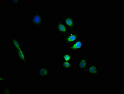 Immunofluorescence(IF) - GFAP Antibody
