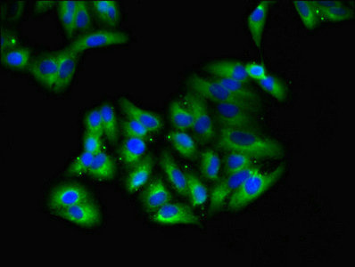 Immunofluorescent analysis of HepG2 cells using CSB-PA009616LA01HU at dilution of 1:100 and Alexa Fluor 488-congugated AffiniPure Goat Anti-Rabbit IgG(H+L)