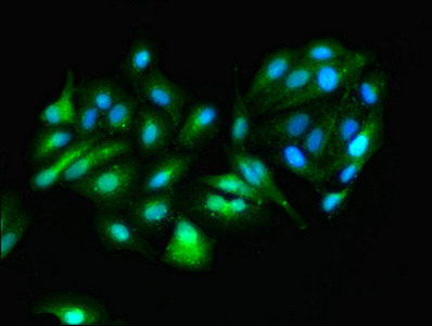 Immunofluorescence(IF) - GOT1 Antibody