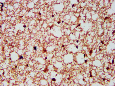 IHC image of CSB-PA009716LA01HU diluted at 1:300 and staining in paraffin-embedded human brain tissue performed on a Leica BondTM system. After dewaxing and hydration, antigen retrieval was mediated by high pressure in a citrate buffer (pH 6.0). Section was blocked with 10% normal goat serum 30min at RT. Then primary antibody (1% BSA) was incubated at 4°C overnight. The primary is detected by a biotinylated secondary antibody and visualized using an HRP conjugated SP system.