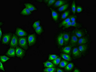 Immunofluorescent analysis of A549 cells using CSB-PA009829LA01HU at dilution of 1:100 and Alexa Fluor 488-congugated AffiniPure Goat Anti-Rabbit IgG(H+L)