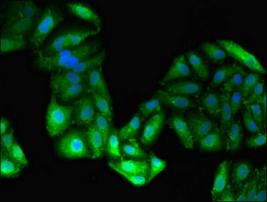 Immunofluorescence(IF) - GPT Antibody