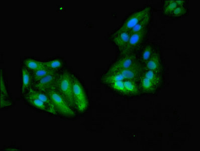 Immunofluorescence(IF) - GSTA1 Antibody