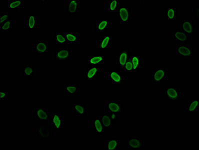 Immunofluorescent analysis of Hela cells (sodium butyrate, 30 mM, 4h) using CSB-PA010100PA11acHU at dilution of 1:100 and Alexa Fluor 488-congugated AffiniPure Goat Anti-Rabbit IgG(H+L) Immunofluorescent analysis of Hela cells (sodium butyrate, 30 mM, 4h) using CSB-PA010100PA11acHU at dilution of 1:100 and Alexa Fluor 488-congugated AffiniPure Goat Anti-Rabbit IgG(H+L)