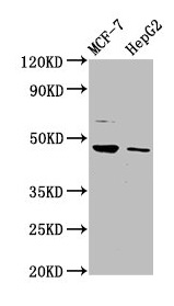 Western Blot Positive WB detected in: MCF-7 whole cell lysate, HepG2 whole cell lysate All lanes: HEPACAM antibody at 3.2microg/ml Secondary Goat polyclonal to rabbit IgG at 1/50000 dilution Predicted band size: 47, 41 kDa Observed band size: 47 kDa