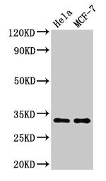 Western Blot Positive WB detected in: Hela whole cell lysate, MCF-7 whole cell lysate All lanes: HIST1H1B antibody at 1.5microg/ml Secondary Goat polyclonal to rabbit IgG at 1/50000 dilution Predicted band size: 23 kDa Observed band size: 32 kDa
