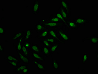 Immunofluorescence(IF) - Formyl-HIST1H1C (K159) Antibody