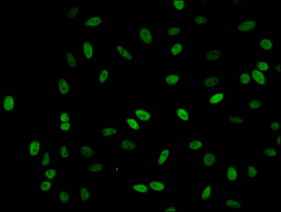 Immunofluorescence(IF) - Acetyl-HIST1H1C (K62) Antibody