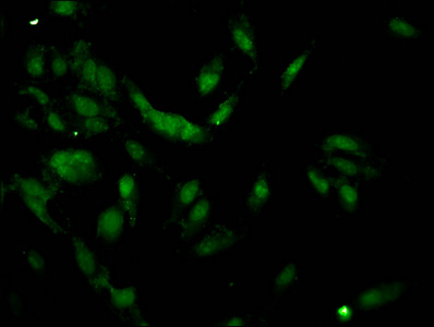 Immunofluorescence(IF) - HIST1H1C (Ab-62) Antibody