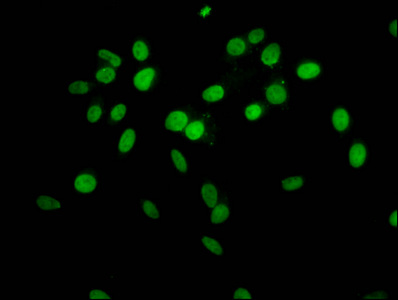 Immunofluorescence(IF) - 2-hydroxyisobutyryl-HIST1H1C (K63) Antibody