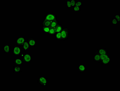 Immunofluorescent analysis of MCF-7 cells using CSB-PA010380PA03phHU at dilution of 1:100 and Alexa Fluor 488-congugated AffiniPure Goat Anti-Rabbit IgG(H+L) Immunofluorescent analysis of MCF-7 cells using CSB-PA010380PA03phHU at dilution of 1:100 and Alexa Fluor 488-congugated AffiniPure Goat Anti-Rabbit IgG(H+L)