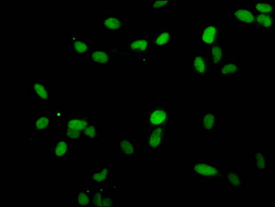 Immunofluorescent analysis of Hela cells using CSB-PA010380PA25me1HU at dilution of 1:100 and Alexa Fluor 488-congugated AffiniPure Goat Anti-Rabbit IgG(H+L) Immunofluorescent analysis of Hela cells using CSB-PA010380PA25me1HU at dilution of 1:100 and Alexa Fluor 488-congugated AffiniPure Goat Anti-Rabbit IgG(H+L)