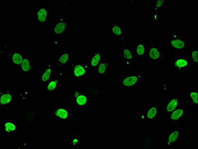 Immunofluorescent analysis of Hela cells using CSB-PA010402NA05nacHU at dilution of 1:100 and Alexa Fluor 488-congugated AffiniPure Goat Anti-Rabbit IgG(H+L)