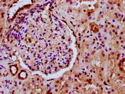 IHC image of CSB-PA010403OA36nogHU diluted at 1:20 and staining in paraffin-embedded human kidney tissue performed on a Leica BondTM system. After dewaxing and hydration, antigen retrieval was mediated by high pressure in a citrate buffer (pH 6.0). Section was blocked with 10% normal goat serum 30min at RT. Then primary antibody (1% BSA) was incubated at 4°C overnight. The primary is detected by a biotinylated secondary antibody and visualized using an HRP conjugated SP system. IHC image of CSB-PA010403OA36nogHU diluted at 1:20 and staining in paraffin-embedded human kidney tissue performed on a Leica BondTM system. After dewaxing and hydration, antigen retrieval was mediated by high pressure in a citrate buffer (pH 6.0). Section was blocked with 10% normal goat serum 30min at RT. Then primary antibody (1% BSA) was incubated at 4°C overnight. The primary is detected by a biotinylated secondary antibody and visualized using an HRP conjugated SP system.
