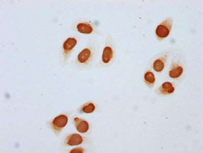 Immunocytochemistry analysis of CSB-PA010403OA85acHU diluted at 1:5 and staining in Hela cells (treated with 30mM sodium butyrate for 4h) performed on a Leica BondTM system. The cells were fixed in 4% formaldehyde, permeabilized using 0.2% Triton X-100 and blocked with 10% normal goat serum 30min at RT. Then primary antibody (1% BSA) was incubated at 4°C overnight. The primary is detected by a biotinylated secondary antibody and visualized using an HRP conjugated SP system. Immunocytochemistry analysis of CSB-PA010403OA85acHU diluted at 1:5 and staining in Hela cells (treated with 30mM sodium butyrate for 4h) performed on a Leica BondTM system. The cells were fixed in 4% formaldehyde, permeabilized using 0.2% Triton X-100 and blocked with 10% normal goat serum 30min at RT. Then primary antibody (1% BSA) was incubated at 4°C overnight. The primary is detected by a biotinylated secondary antibody and visualized using an HRP conjugated SP system.