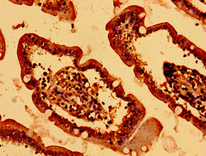 Immunohistochemistry of paraffin-embedded human small intestine tissue using CSB-PA010411LA01HU at dilution of 1:100 Immunohistochemistry of paraffin-embedded human small intestine tissue using CSB-PA010411LA01HU at dilution of 1:100