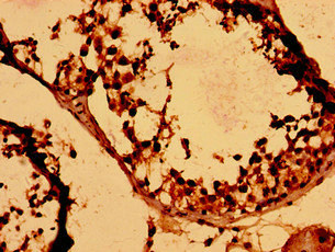 Immunohistochemistry of paraffin-embedded human testis tissue using CSB-PA010411LA01HU at dilution of 1:100