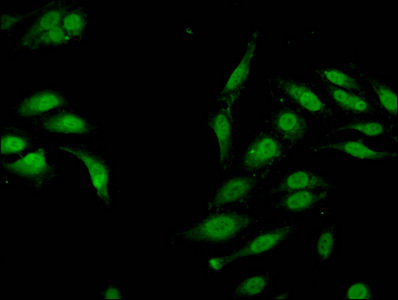Immunofluorescent analysis of Hela cells using CSB-PA010418OA04me1HU at dilution of 1:100 and Alexa Fluor 488-congugated AffiniPure Goat Anti-Rabbit IgG(H+L) Immunofluorescent analysis of Hela cells using CSB-PA010418OA04me1HU at dilution of 1:100 and Alexa Fluor 488-congugated AffiniPure Goat Anti-Rabbit IgG(H+L)