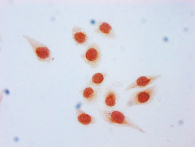 Immunocytochemistry analysis of CSB-PA010418OA09bhbHU diluted at 1:15 and staining in Hela cells (treated with 50mM sodium 3-hydroxybutyrate for 72h) performed on a Leica BondTM system. The cells were fixed in 4% formaldehyde, permeabilized using 0.2% Triton X-100 and blocked with 10% normal goat serum 30min at RT. Then primary antibody (1% BSA) was incubated at 4°C overnight. The primary is detected by a biotinylated secondary antibody and visualized using an HRP conjugated SP system.