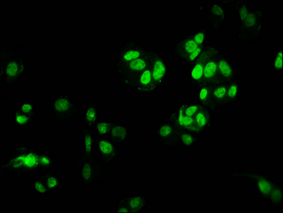Immunofluorescence staining of MCF-7 cells with CSB-PA010418OA09ncrHU at 1:1, counter-stained with DAPI. The cells were fixed in 4% formaldehyde, permeabilized using 0.2% Triton X-100 and blocked in 10% normal Goat Serum. The cells were then incubated with the antibody overnight at 4°C. The secondary antibody was Alexa Fluor 488-congugated AffiniPure Goat Anti-Rabbit IgG(H+L).