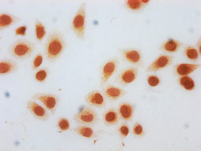 Immunocytochemistry analysis of CSB-PA010418OA122bhbHU diluted at 1:10 and staining in Hela cells (treated with 50mM sodium 3-hydroxybutyrate for 72h) performed on a Leica BondTM system. The cells were fixed in 4% formaldehyde, permeabilized using 0.2% Triton X-100 and blocked with 10% normal goat serum 30min at RT. Then primary antibody (1% BSA) was incubated at 4°C overnight. The primary is detected by a biotinylated secondary antibody and visualized using an HRP conjugated SP system.