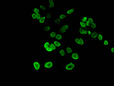 Immunofluorescent analysis of Hela cells using CSB-PA010418OA27nme3HU at dilution of 1:100 and Alexa Fluor 488-congugated AffiniPure Goat Anti-Rabbit IgG(H+L)