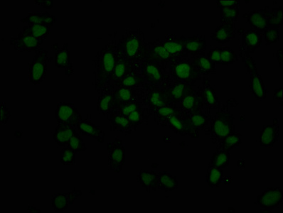 Immunofluorescence staining of Hela cells with CSB-PA010418OA45nphHU at 1:5, counter-stained with DAPI. The cells were fixed in 4% formaldehyde, permeabilized using 0.2% Triton X-100 and blocked in 10% normal Goat Serum. The cells were then incubated with the antibody overnight at 4°C. The secondary antibody was Alexa Fluor 488-congugated AffiniPure Goat Anti-Rabbit IgG(H+L).