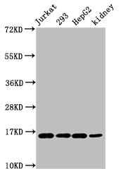 Western Blot Positive WB detected in: Jurkat whole cell lysate, 293 whole cell lysate, HepG2 whole cell lysate, Mouse kidney tissue All lanes: HIST1H3A antibody at 0.64microg/ml Secondary Goat polyclonal to rabbit IgG at 1/50000 dilution Predicted band size: 16 kDa Observed band size: 16 kDa Western Blot Positive WB detected in: Jurkat whole cell lysate, 293 whole cell lysate, HepG2 whole cell lysate, Mouse kidney tissue All lanes: HIST1H3A antibody at 0.64microg/ml Secondary Goat polyclonal to rabbit IgG at 1/50000 dilution Predicted band size: 16 kDa Observed band size: 16 kDa