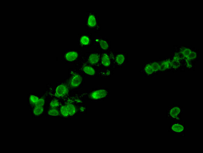 Immunofluorescent analysis of Hela cells using CSB-PA010418PA09nme2HU at dilution of 1:100 and Alexa Fluor 488-congugated AffiniPure Goat Anti-Rabbit IgG(H+L)