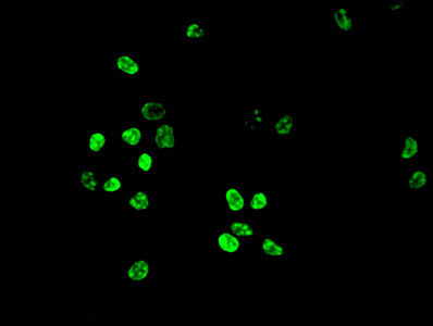 Immunofluorescent analysis of Hela cells using CSB-PA010418PA10nphHU at dilution of 1:100 and Alexa Fluor 488-congugated AffiniPure Goat Anti-Rabbit IgG(H+L)
