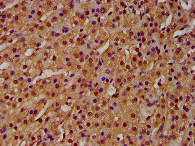 IHC image of CSB-PA010429OA20nme3HU diluted at 1:100 and staining in paraffin-embedded human adrenal gland tissue performed on a Leica BondTM system. After dewaxing and hydration, antigen retrieval was mediated by high pressure in a citrate buffer (pH 6.0). Section was blocked with 10% normal goat serum 30min at RT. Then primary antibody (1% BSA) was incubated at 4°C overnight. The primary is detected by a biotinylated secondary antibody and visualized using an HRP conjugated SP system.