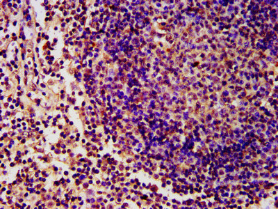 IHC image of CSB-PA010429OA31npropHU diluted at 1:15 and staining in paraffin-embedded human lymph node tissue performed on a Leica BondTM system. After dewaxing and hydration, antigen retrieval was mediated by high pressure in a citrate buffer (pH 6.0). Section was blocked with 10% normal goat serum 30min at RT. Then primary antibody (1% BSA) was incubated at 4°C overnight. The primary is detected by a biotinylated secondary antibody and visualized using an HRP conjugated SP system.