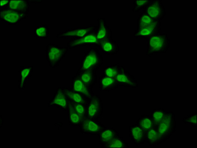 Immunofluorescence staining of Hela cells with CSB-PA010429OA35me1HU at 1:2.5, counter-stained with DAPI. The cells were fixed in 4% formaldehyde, permeabilized using 0.2% Triton X-100 and blocked in 10% normal Goat Serum. The cells were then incubated with the antibody overnight at 4°C. The secondary antibody was Alexa Fluor 488-congugated AffiniPure Goat Anti-Rabbit IgG(H+L). Immunofluorescence staining of Hela cells with CSB-PA010429OA35me1HU at 1:2.5, counter-stained with DAPI. The cells were fixed in 4% formaldehyde, permeabilized using 0.2% Triton X-100 and blocked in 10% normal Goat Serum. The cells were then incubated with the antibody overnight at 4°C. The secondary antibody was Alexa Fluor 488-congugated AffiniPure Goat Anti-Rabbit IgG(H+L).