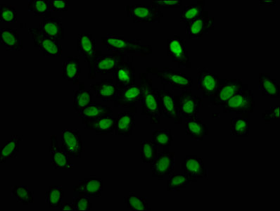 Immunofluorescence staining of Hela cells with CSB-PA010600HA01HU at 1:100, counter-stained with DAPI. The cells were fixed in 4% formaldehyde, permeabilized using 0.2% Triton X-100 and blocked in 10% normal Goat Serum. The cells were then incubated with the antibody overnight at 4°C. The secondary antibody was Alexa Fluor 488-congugated AffiniPure Goat Anti-Rabbit IgG(H+L). Immunofluorescence staining of Hela cells with CSB-PA010600HA01HU at 1:100, counter-stained with DAPI. The cells were fixed in 4% formaldehyde, permeabilized using 0.2% Triton X-100 and blocked in 10% normal Goat Serum. The cells were then incubated with the antibody overnight at 4°C. The secondary antibody was Alexa Fluor 488-congugated AffiniPure Goat Anti-Rabbit IgG(H+L).