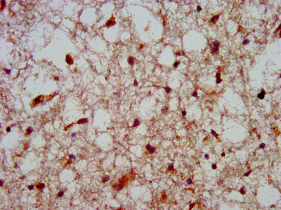 IHC image of CSB-PA010654LA01HU diluted at 1:800 and staining in paraffin-embedded human brain tissue performed on a Leica BondTM system. After dewaxing and hydration, antigen retrieval was mediated by high pressure in a citrate buffer (pH 6.0). Section was blocked with 10% normal goat serum 30min at RT. Then primary antibody (1% BSA) was incubated at 4°C overnight. The primary is detected by a biotinylated secondary antibody and visualized using an HRP conjugated SP system.