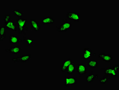 Immunofluorescent analysis of Hela cells using CSB-PA010672LA01HU at dilution of 1:100 and Alexa Fluor 488-congugated AffiniPure Goat Anti-Rabbit IgG(H+L)