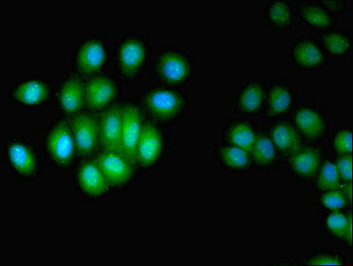 Immunofluorescent analysis of A549 cells using CSB-PA010909LA01HU at dilution of 1:100 and Alexa Fluor 488-congugated AffiniPure Goat Anti-Rabbit IgG(H+L)