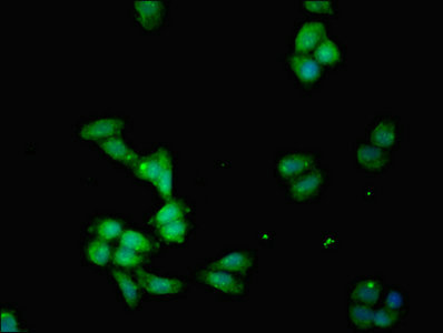 Immunofluorescence(IF) - IDO1 Antibody