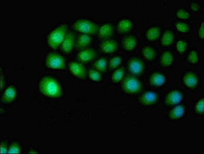 Immunofluorescent analysis of A549 cells using CSB-PA010997LA01HU at dilution of 1:100 and Alexa Fluor 488-congugated AffiniPure Goat Anti-Rabbit IgG(H+L)